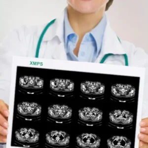 Imprimante PAPIER DICOM